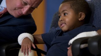 greffé des deux mains 